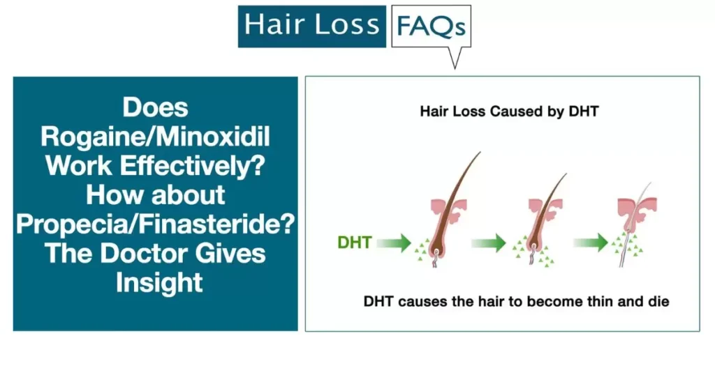 How does Minoxidil work?