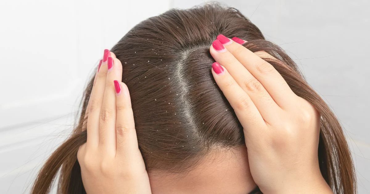 How to Get Rid of Frizzy Hair Permanently