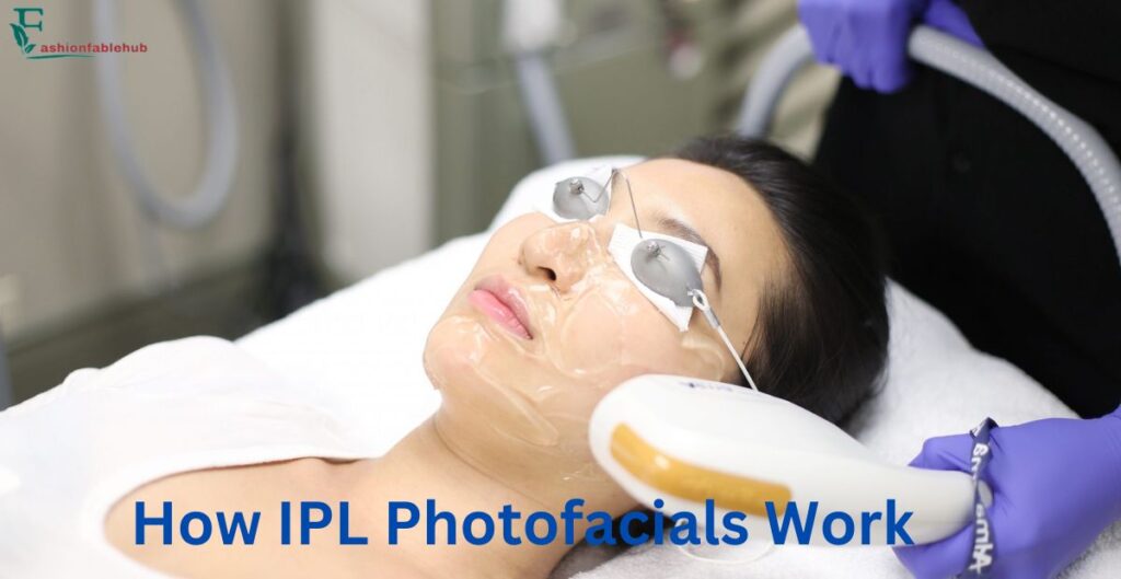 How IPL Photofacials Work