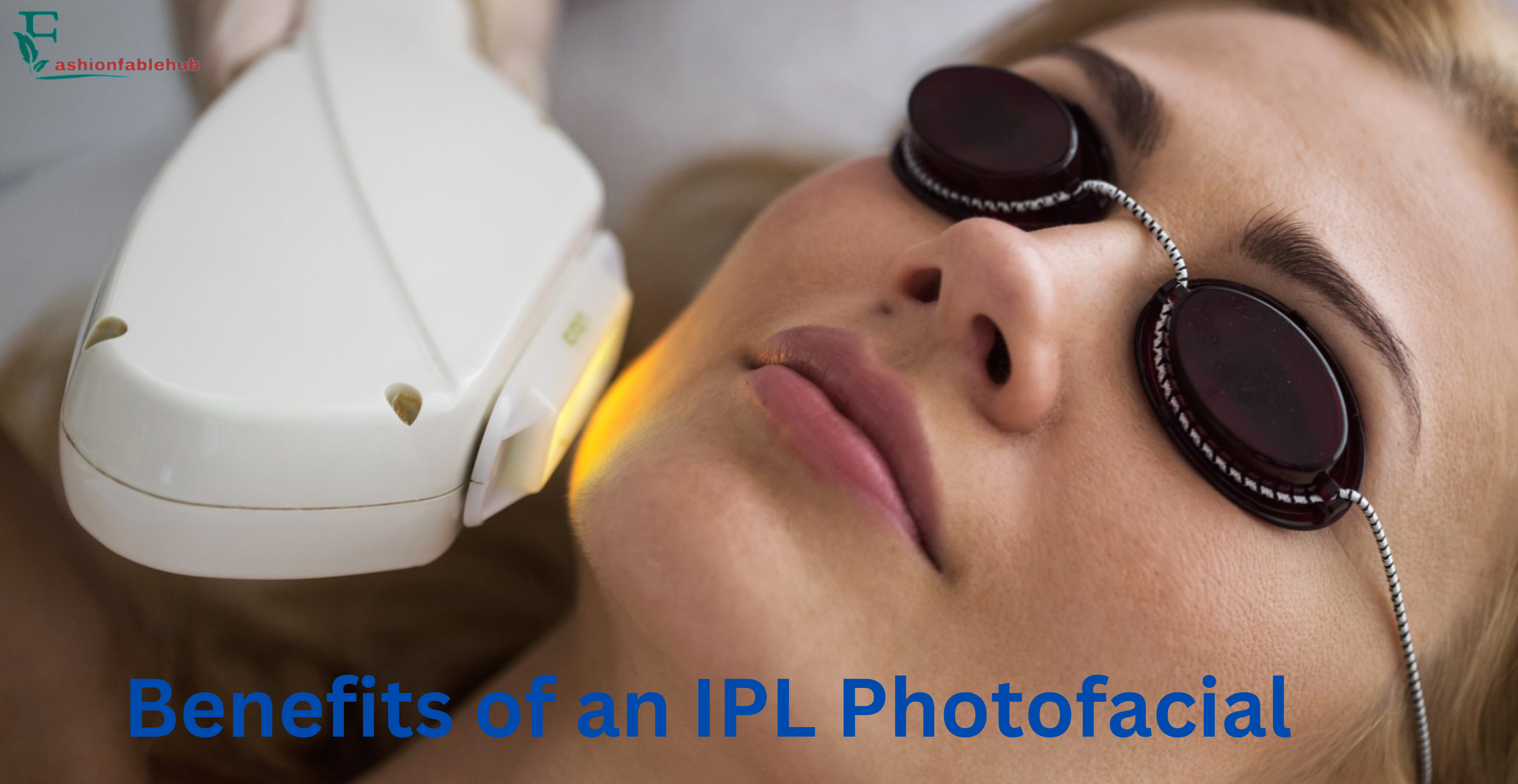Benefits of an IPL Photofacial
