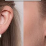 How To Wear Earrings With A Split Earlobe?