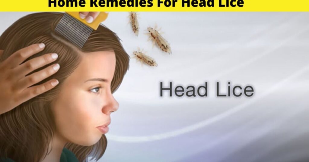 How to Prevent Lice Infestation Naturally