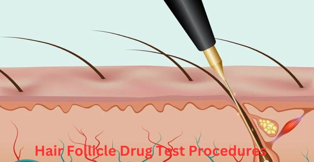 Hair Follicle Drug Test Procedures